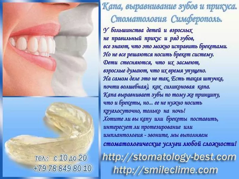 Современная и доступная имплантология,  стоматология Симферополь 3