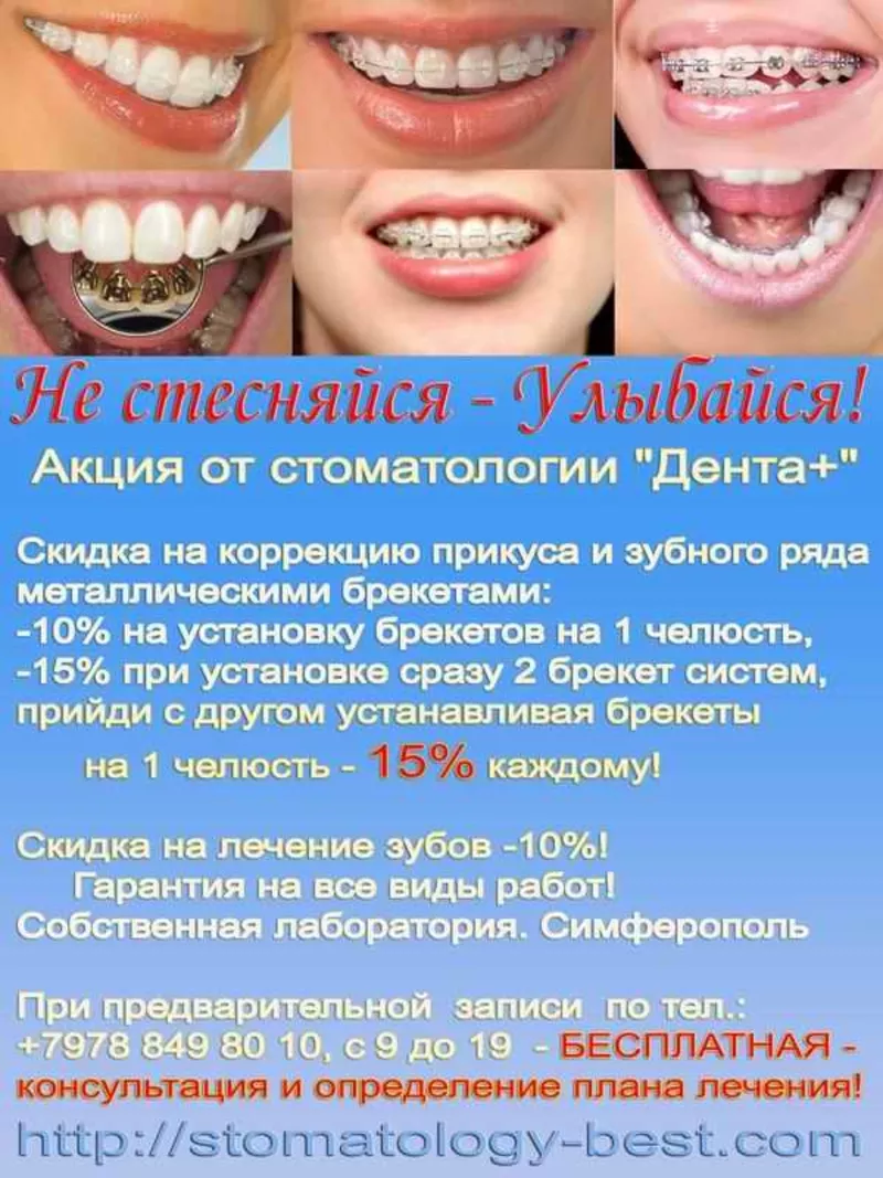 Cамые современные технологии  протезирования зубов,  Симферополь 3